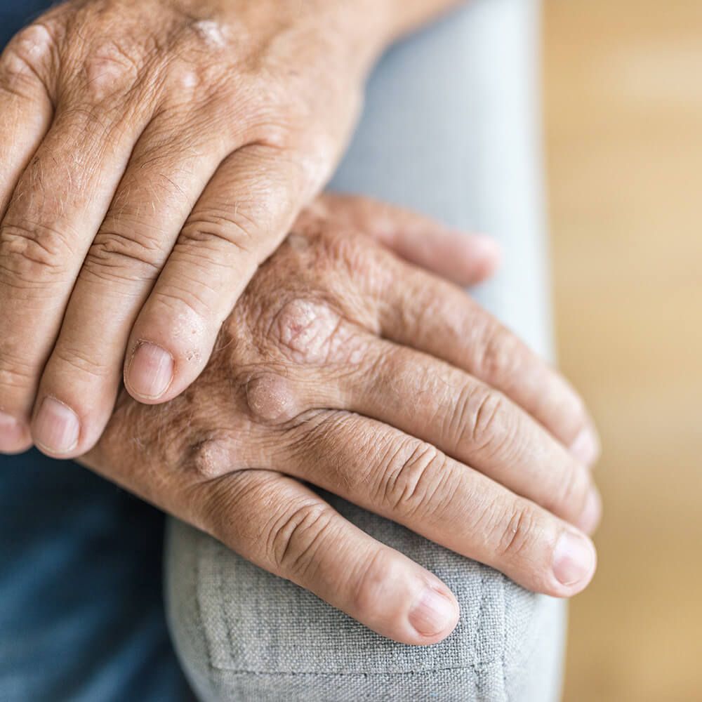 The elderly man's hands are folded together on the armrest of a gray chair